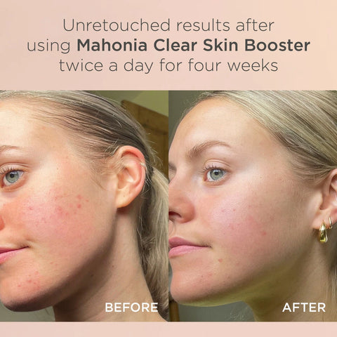 Mahonia Spot Treatment Booster 25ml